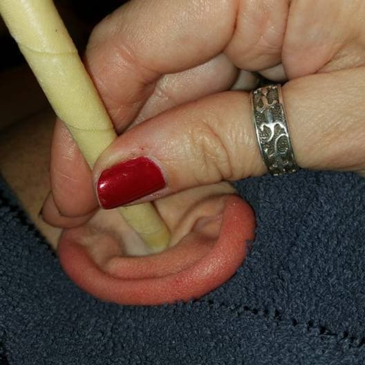 Ear Coning Package x 3 at Deep Breath Salon & Holistic Center in Western Cranston, RI